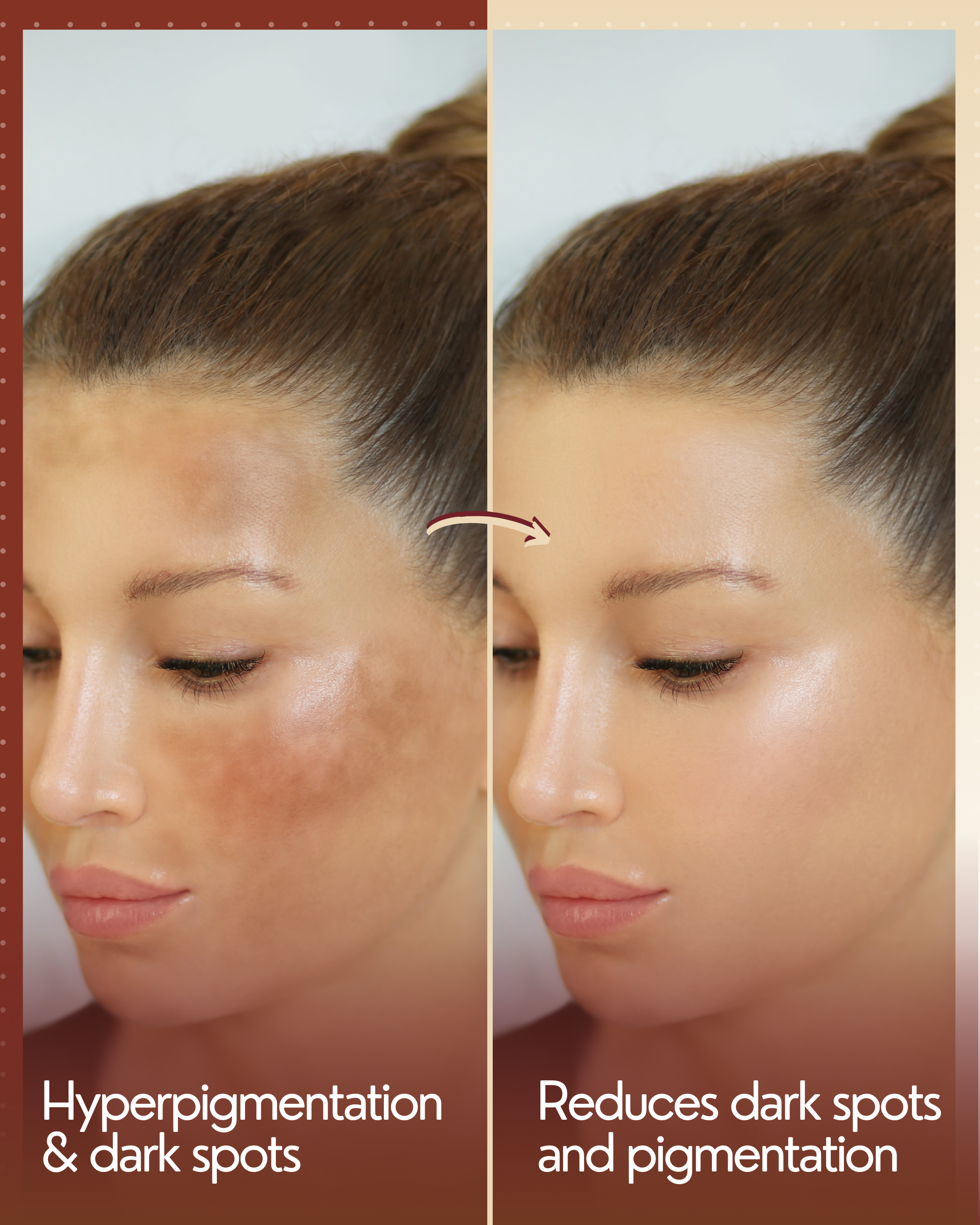 Dark Spots